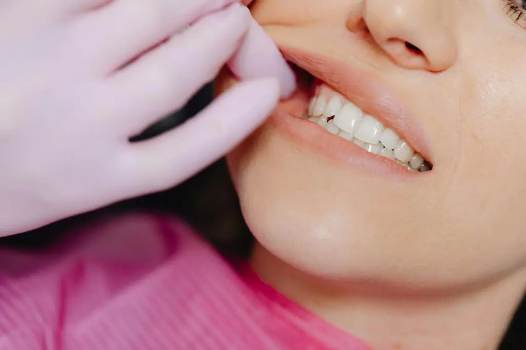 Veneers in Berlin